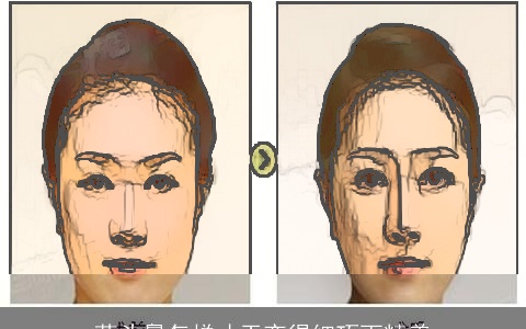 蒜头鼻怎样才干变得细巧而精美