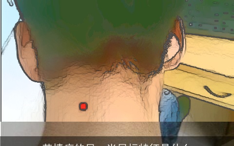 苦情痣的另一半目标特征是什么