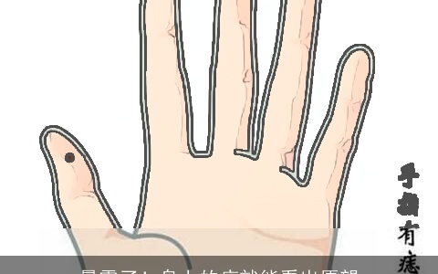 暴露了！身上的痣就能看出愿望