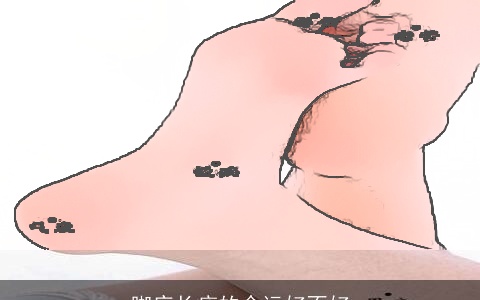 脚底长痣的命运好不好