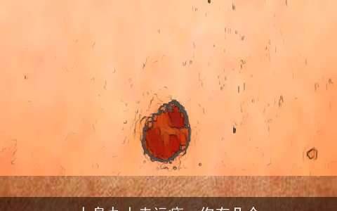 人身九大走运痣，你有几个