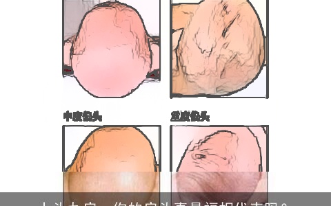 十头九扁，你的扁头真是福相代表吗？