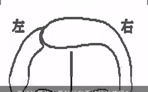 天柱纹是什么悬针纹和天柱纹的差异？