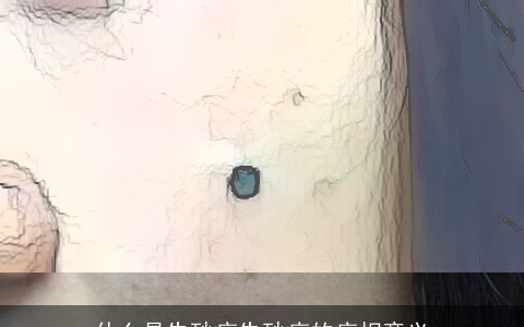 什么是朱砂痣朱砂痣的痣相意义