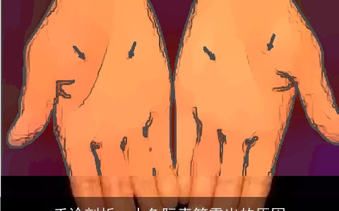 手诊剖析：大鱼际青筋露出的原因