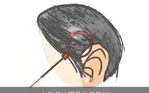 女性身体哪里长痣最好