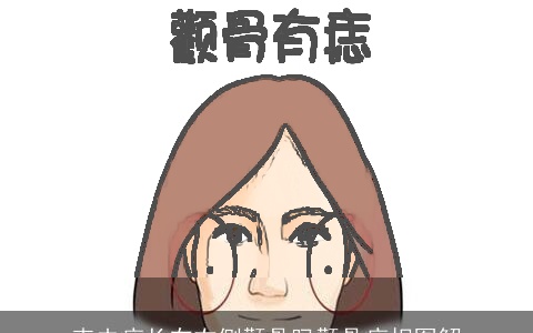 克夫痣长在右侧颧骨吗颧骨痣相图解