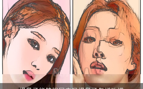 塌鼻子能够捏回来吗塌鼻子怎样改进