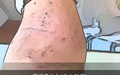 害疮是什么(什么叫疮)