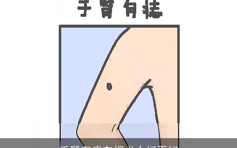 手臂有痣在相术中好不好