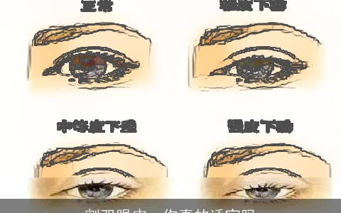 割双眼皮，你真的适宜吗
