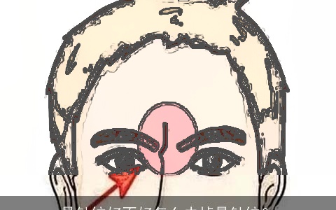 悬针纹好不好怎么去掉悬针纹？