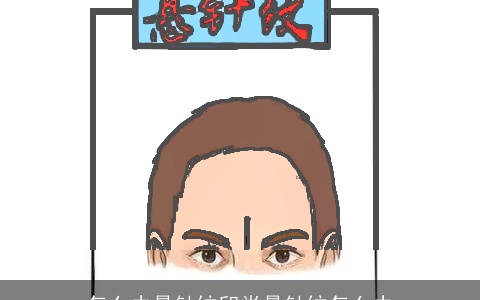 怎么去悬针纹印堂悬针纹怎么去