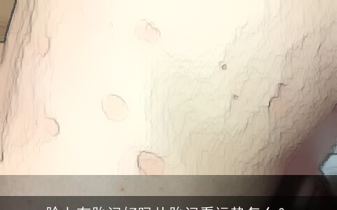 脸上有胎记好吗从胎记看运势怎么？