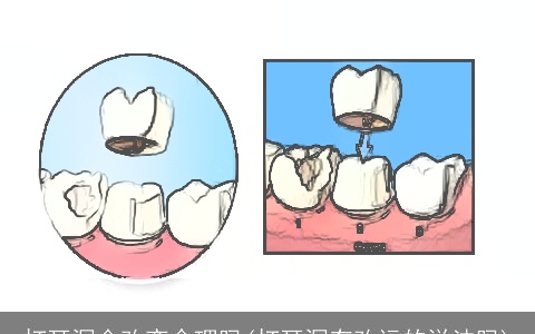 打耳洞会改变命理吗(打耳洞有改运的说法吗)