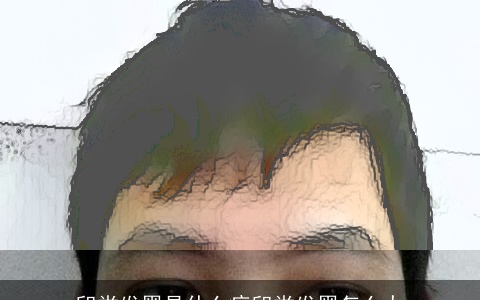 印堂发黑是什么病印堂发黑怎么办