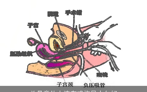总是意外人流有或许风水欠好