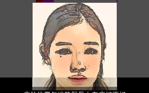 痣的位置与运势颧骨上有痣好不好