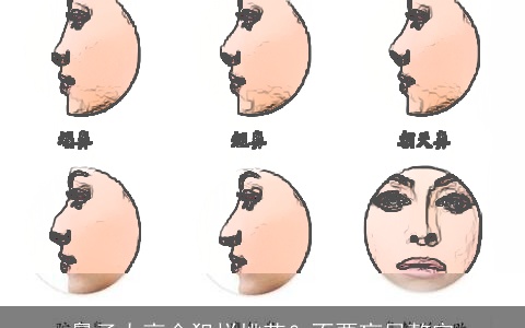 鼻子太高会犯烂桃花？不要盲目整容