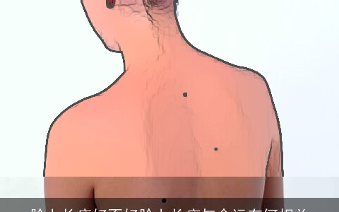 脸上长痣好不好脸上长痣与命运有何相关