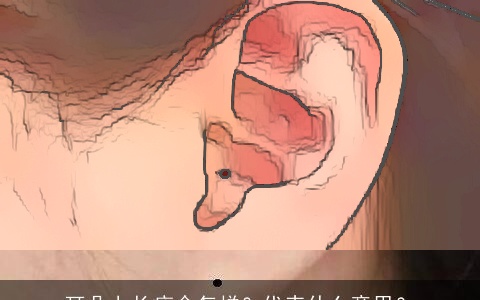 耳朵上长痣命怎样？代表什么意思？