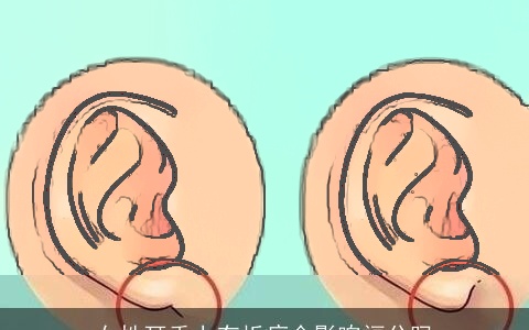 女性耳垂上有折痕会影响福分吗