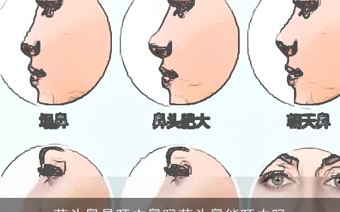 蒜头鼻是旺夫鼻吗蒜头鼻能旺夫吗