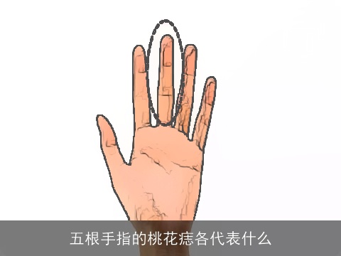 五根手指的桃花痣各代表什么