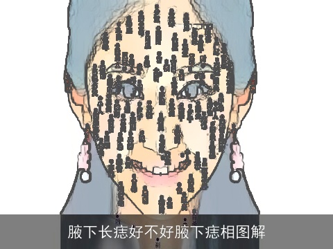 腋下长痣好不好腋下痣相图解