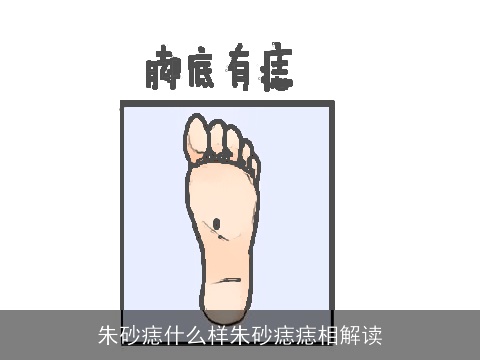 朱砂痣什么样朱砂痣痣相解读