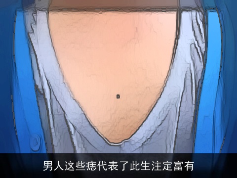 男人这些痣代表了此生注定富有