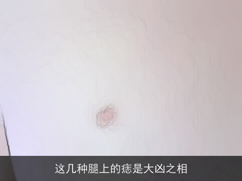 这几种腿上的痣是大凶之相