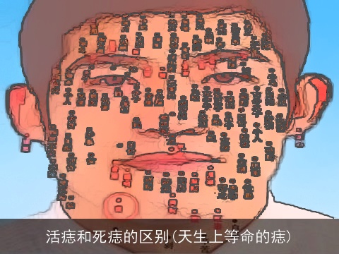 活痣和死痣的区别(天生上等命的痣)