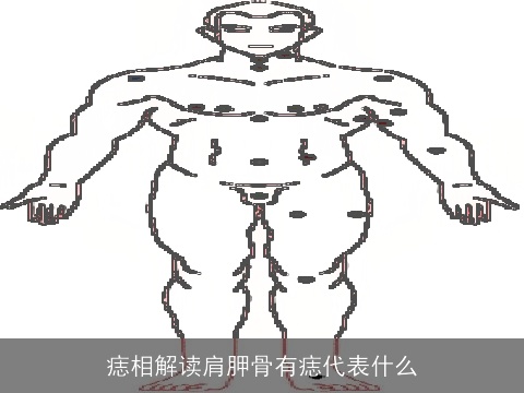 痣相解读肩胛骨有痣代表什么