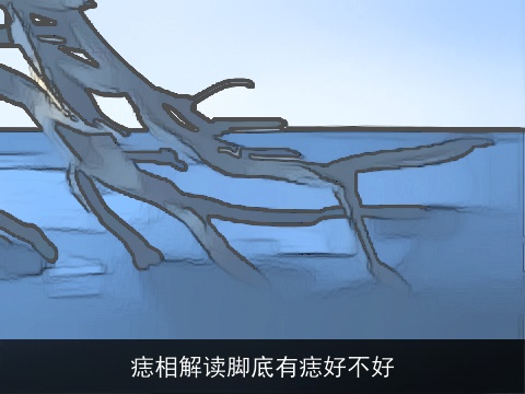 痣相解读脚底有痣好不好