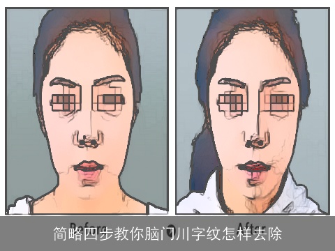 简略四步教你脑门川字纹怎样去除