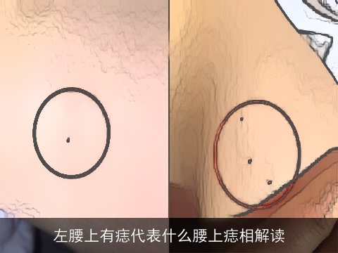 左腰上有痣代表什么腰上痣相解读