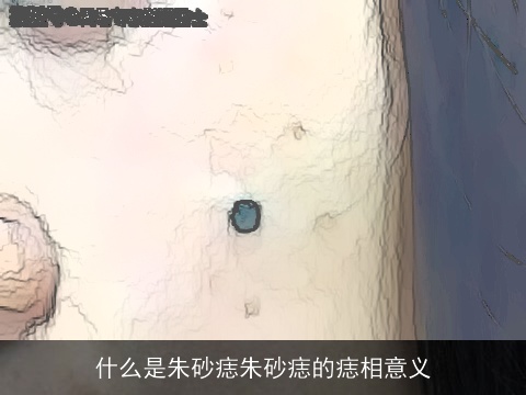 什么是朱砂痣朱砂痣的痣相意义