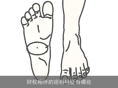 财权相伴的痣相特征有哪些