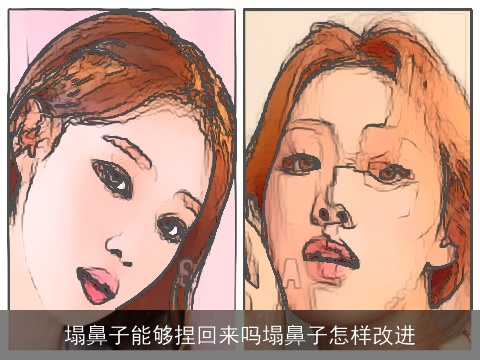 塌鼻子能够捏回来吗塌鼻子怎样改进