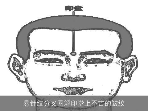 悬针纹分叉图解印堂上不吉的皱纹