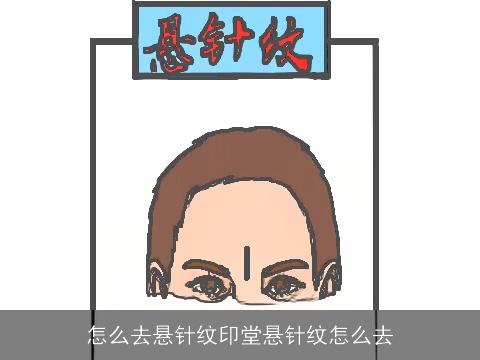 怎么去悬针纹印堂悬针纹怎么去