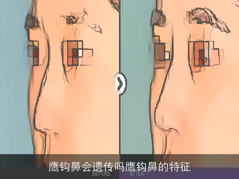 鹰钩鼻会遗传吗鹰钩鼻的特征