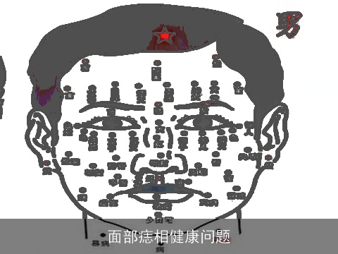 面部痣相健康问题
