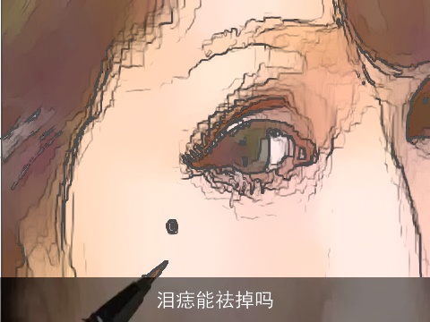 泪痣能祛掉吗