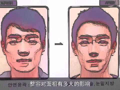 整容对面相有多大的影响