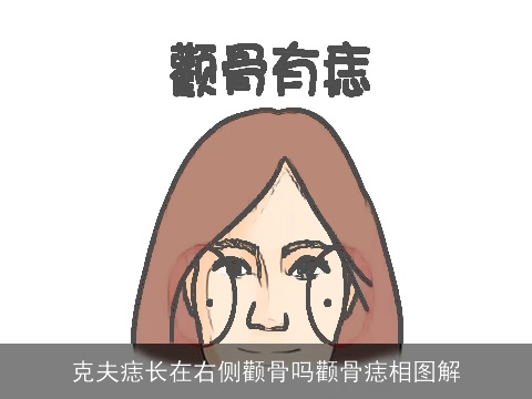 克夫痣长在右侧颧骨吗颧骨痣相图解
