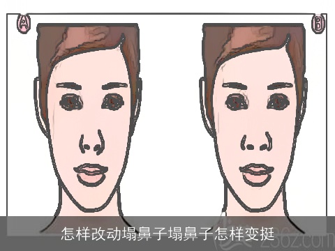 怎样改动塌鼻子塌鼻子怎样变挺