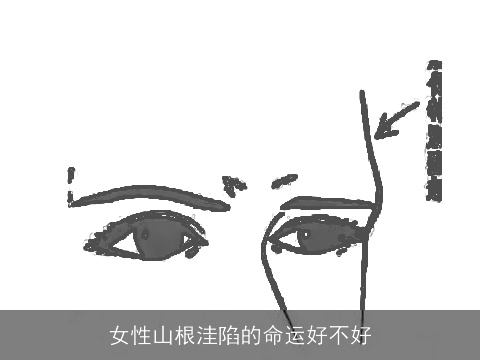 女性山根洼陷的命运好不好