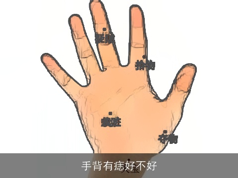 手背有痣好不好